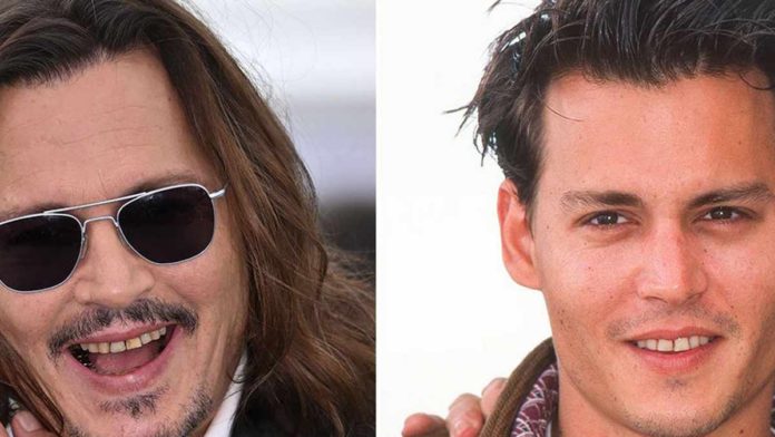 Johnny Depp Says He's 'proud' Of His 'rotting Teeth' With 'loads Of ...