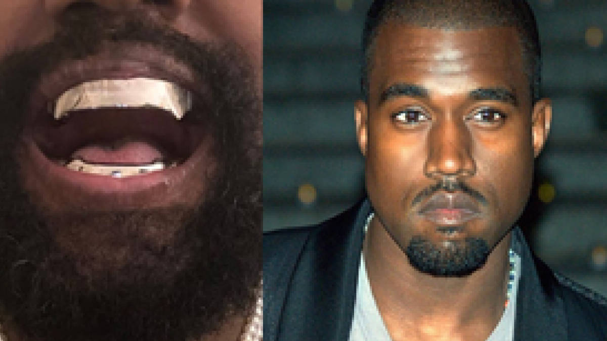 Kanye West Replaces Teeth With Titanium Gnashers | Glamsham