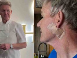 Gordon Ramsay Reveals Skin Cancer Surgery, Urges Fans to Wear Sunscreen