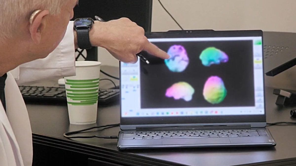 Kim Kardashian'S Brain Scan Reveals Alarming News: &Quot;Low Activity&Quot; Sparks Concerns! 1 kim kardashian brain scan