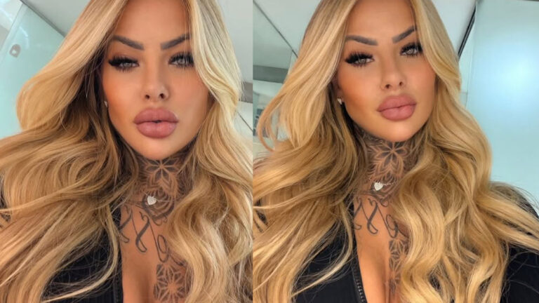Influencer Bianca Dias Dies Days After Cosmetic Surgery