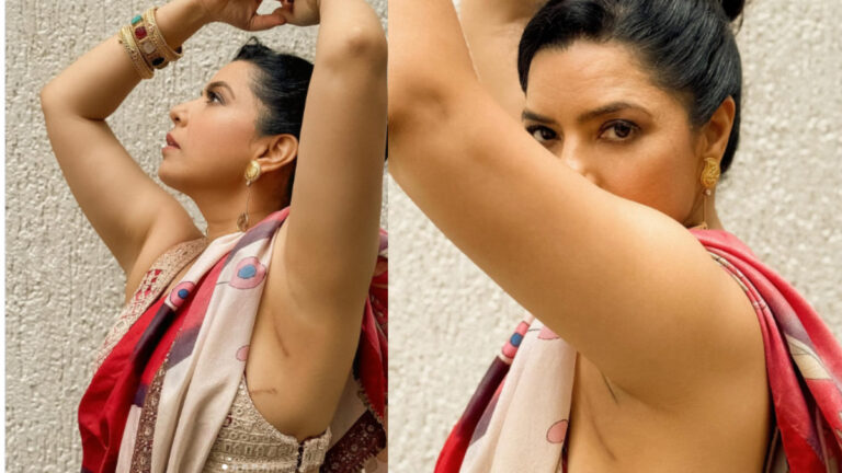 Rajshri Deshpande Flaunts Surgery Scars During Film Promotions Wins Hearts Online