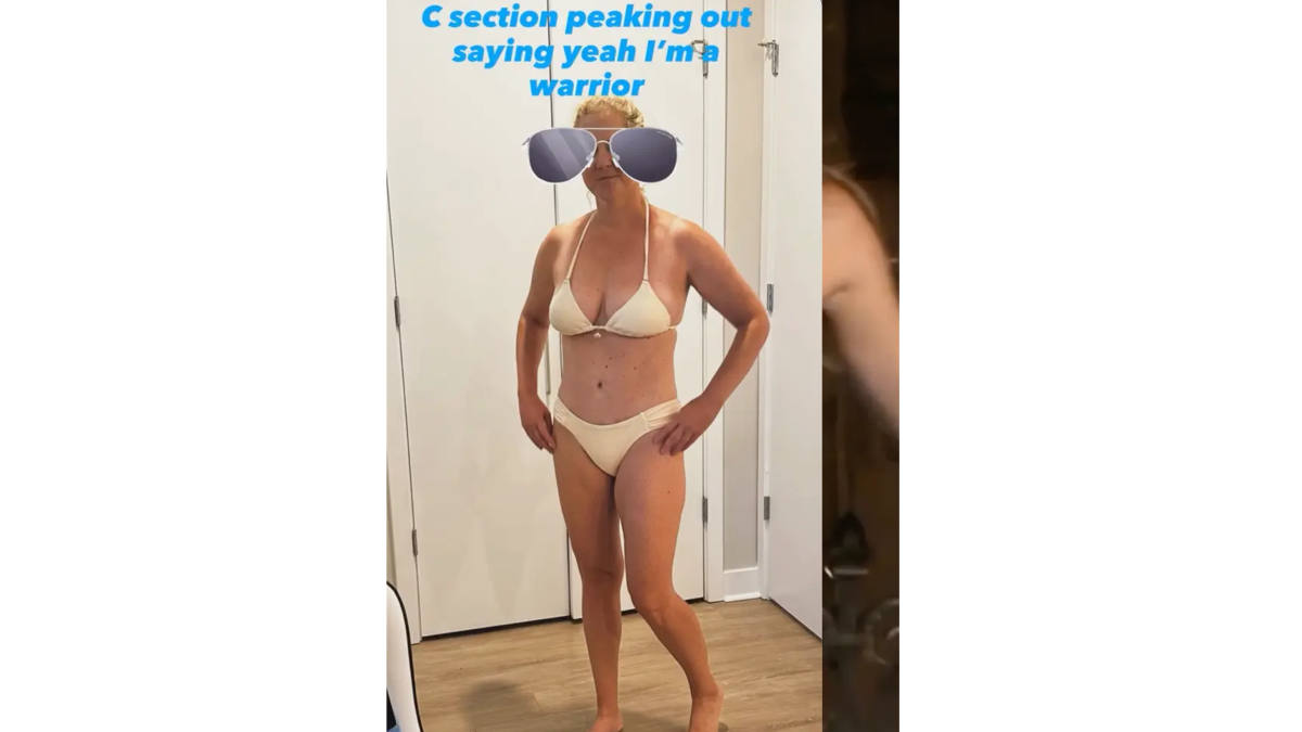 Amy Schumer Proudly Shows Her C Section Scar And Sends A Powerful Message To Moms 1 amy schumer shares bold bikini photo and celebrates the scar that changed her life