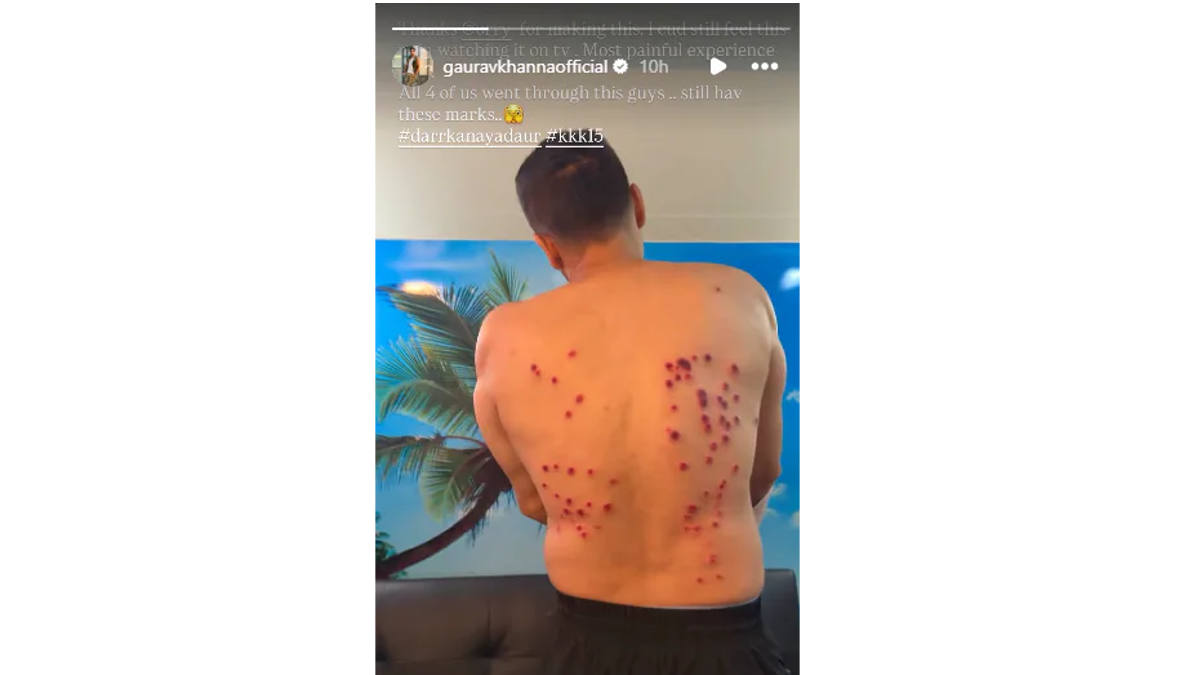 gaurav khanna shares brutal injury video amid bullying claims